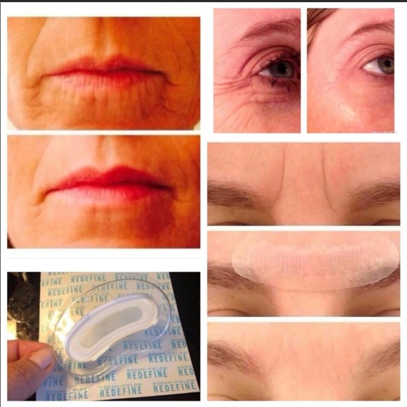 R+F Acute Care Redefine Wrinkle Strips - Picture 2 of 7